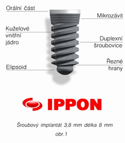 implantat